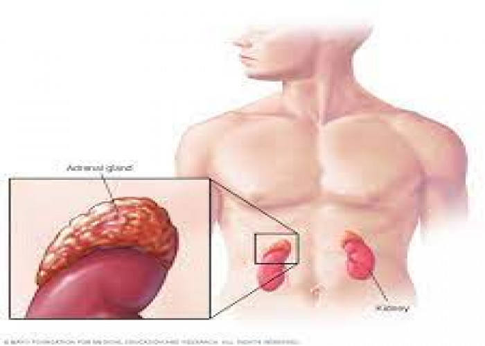 Benign adrenal tumors