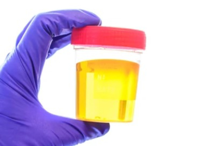 Lot of urine