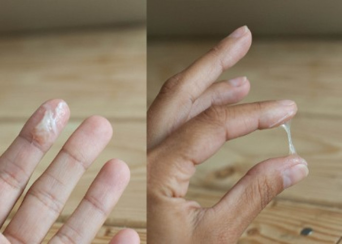 Mucous discharge