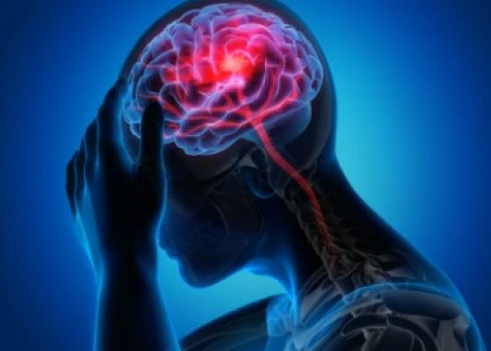 Nervous headache