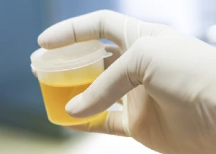 Scanty urine