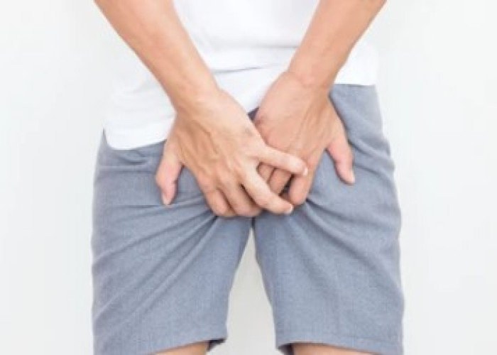 Anal fistula