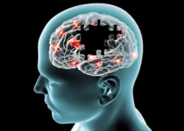 Alzheimers disease