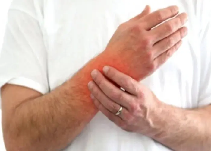 De Quervain's tenosynovitis