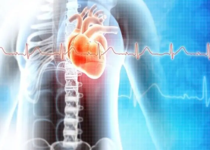 Heart arrhythmia