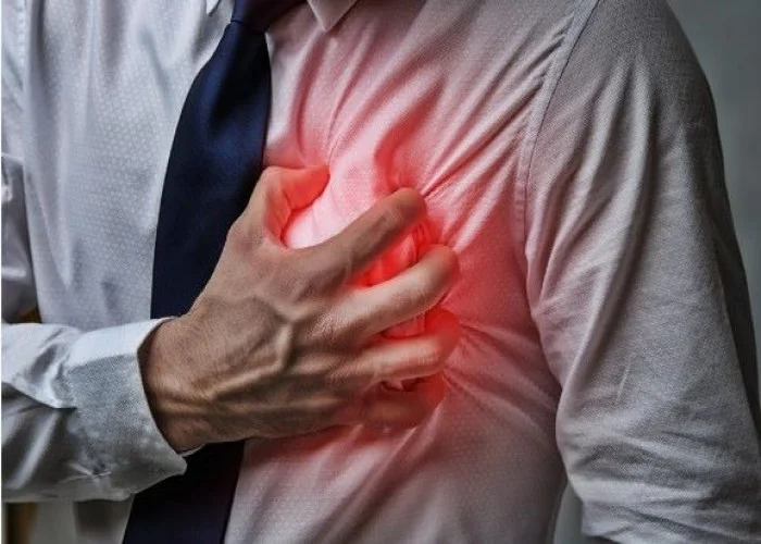 Heart attack
