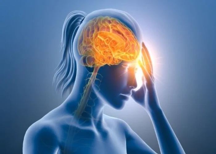 Migraine with aura