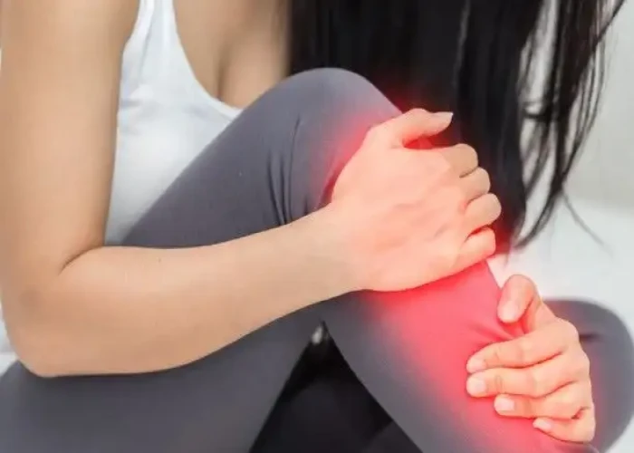Shin splints