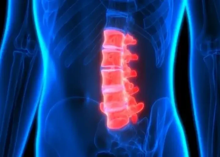 Spinal cord injury