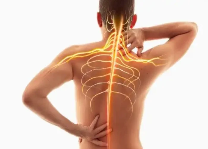 Spinal headaches