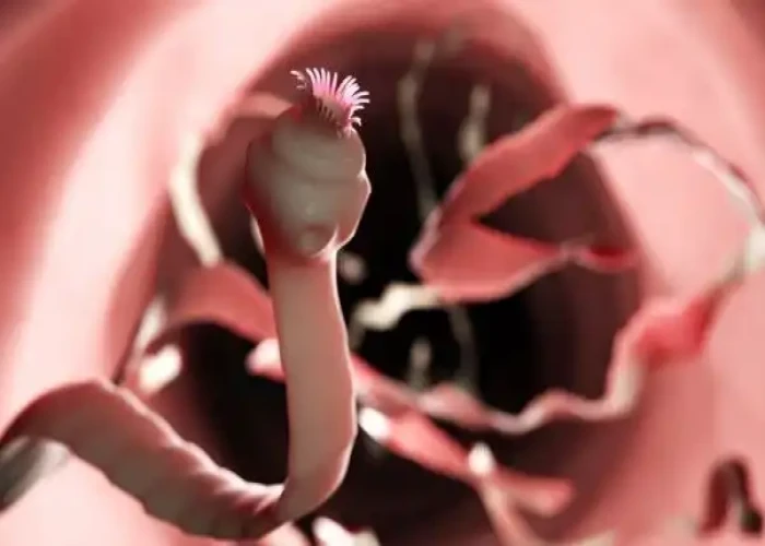 Tape Worm