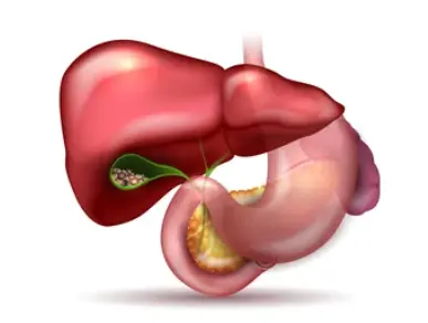 Biliary disease
