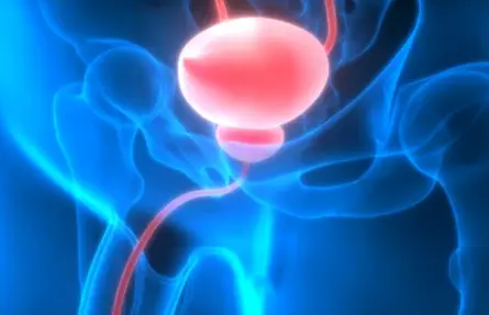Bladder disease