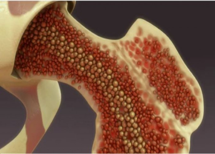 Bone marrow