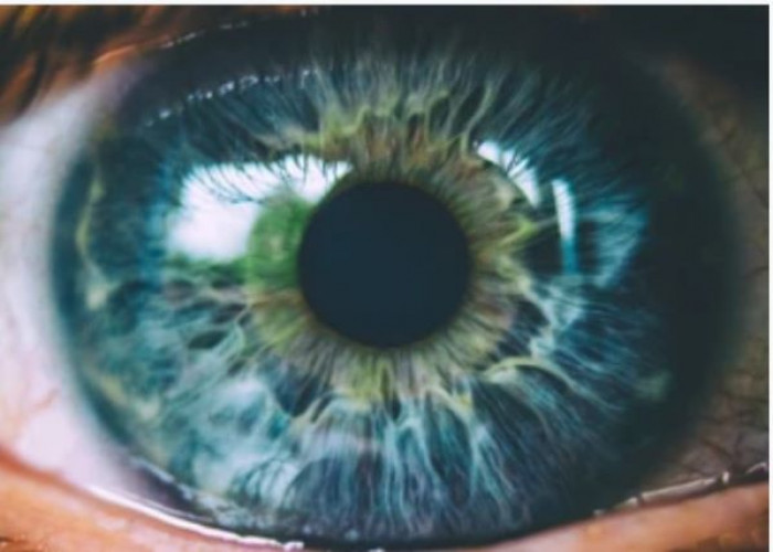 Iris Eye