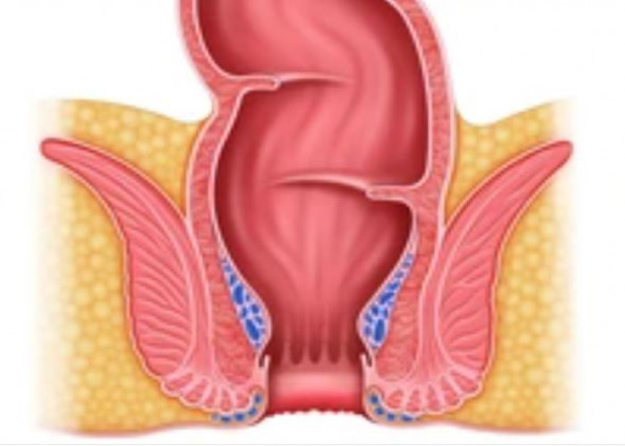 Rectum