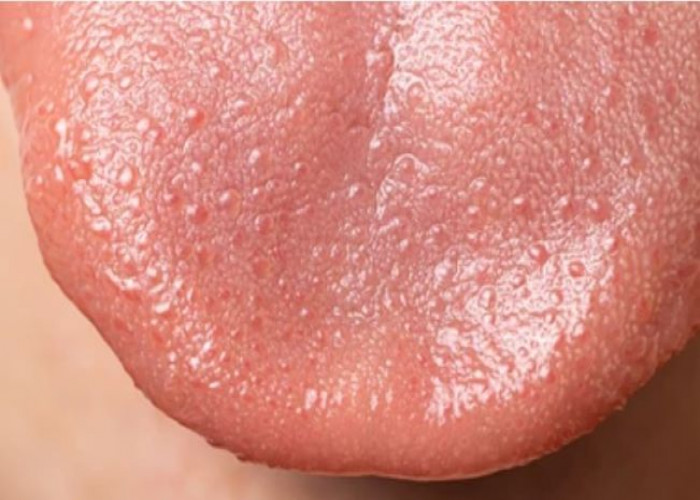 Taste buds Tongue