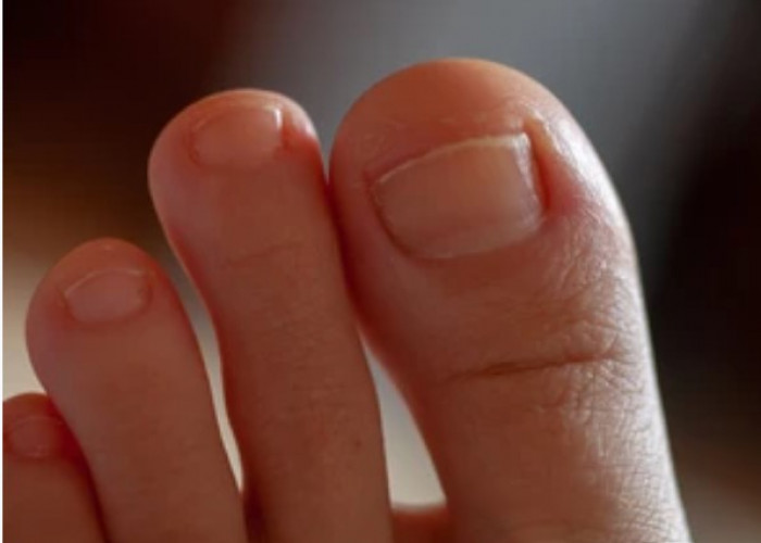 Toe