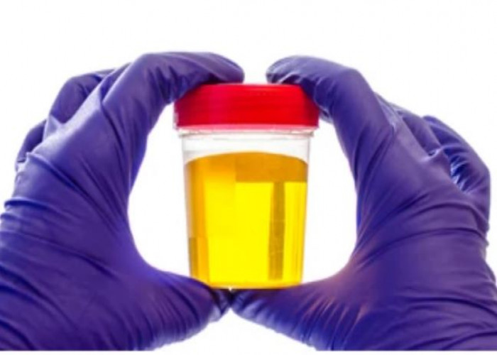 Urine