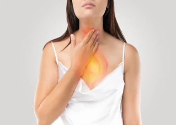 Acid reflux