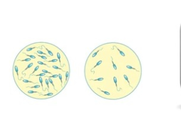 Sperm loss