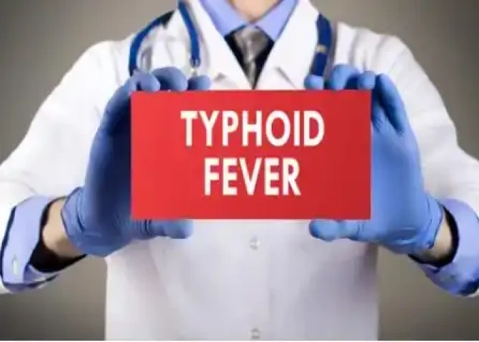 Typhoid