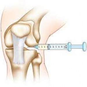 Injection